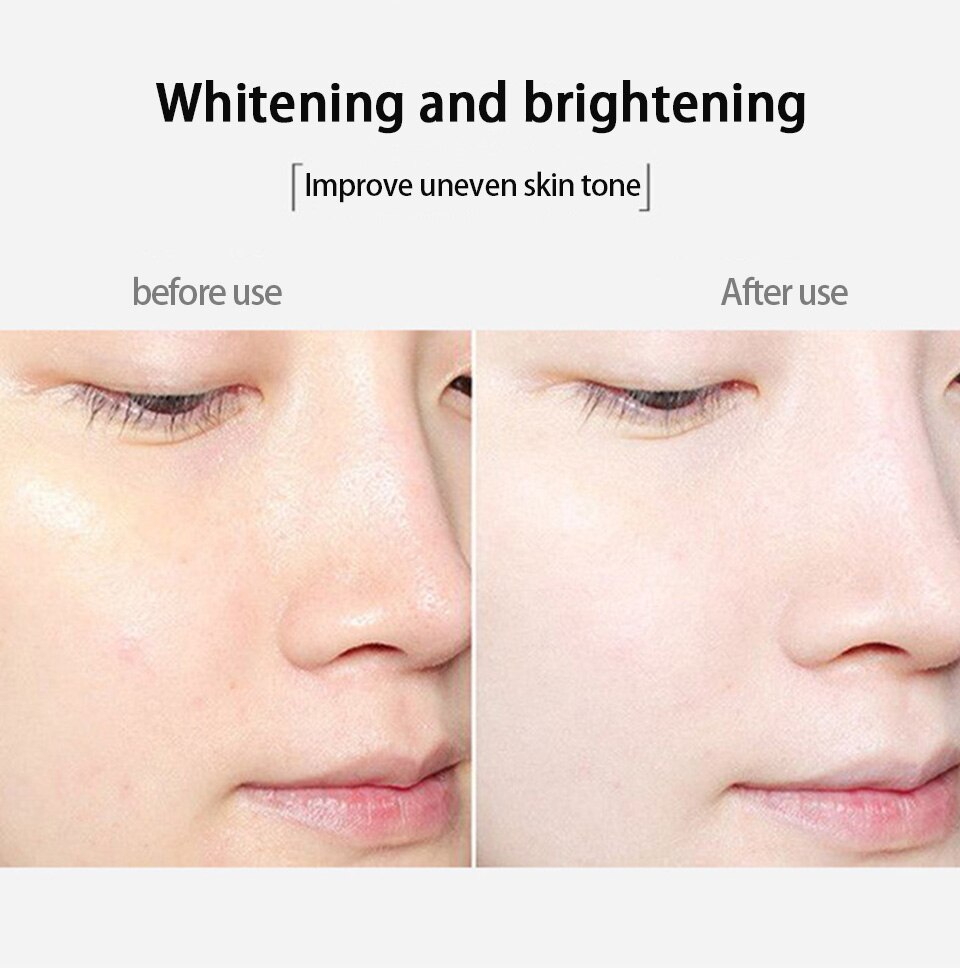 YOUNGCOME 30ml 50ml Vitamin C Retinol Facial Serum Whitening Brightening Moisturizing Lighten Spots Hyaluronic Acid Eyes Essence