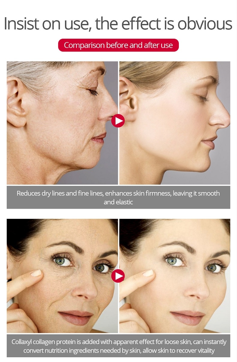 10 Gift 1 Retinol Anti-Aging Wrinkle Whitening Freckle Cream Remove Dark Spots Moisturizing Lifting Firming Repair Skin Care