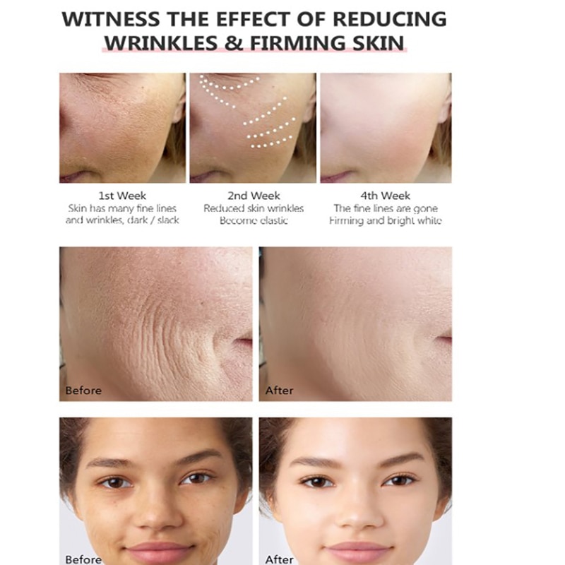 Retinol Face Serum Anti Aging Serum Dark Spot Corrector 30ML For Lines Wrinkles Boost Collagen Aid Acne Treatment
